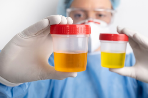 What is Synthetic Urine